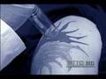 Tattoo MD Laser Clinic - Dr. Alex Kaplan