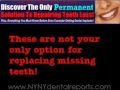 Dr. Rosenberg, New York City Cosmetic Dentist explains the secret to replacing lost teeth.