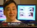 Asian plastic surgery on CNN