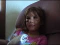 Dog bite victim