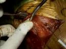 shoulder-arthroscopy-dr-allan-mishra-emedxcom.html