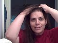 Gastric Bypass Hair Loss: Grow It Back With Scalp Massage