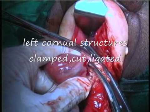 vaginal