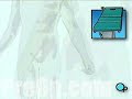Malpractice Medical Knee Replacement Surgery 2 | Education Videos,education-videos free online video
