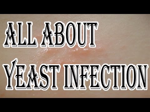 how to know yeast infection