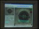 What do LASIK Lasers and Muscle Cars have in Common?
