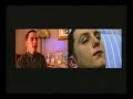 Lasers and acne: RTE TV interview