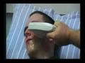 Lasers and acne: RTE TV interview