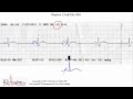 ECG Interpretation, Intermediate Level - Part 4 ECG Interpretation, Intermediate Level - Part 4