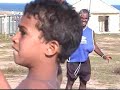 Um Milhão de Pequenos Raios