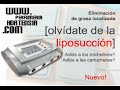 NARL [517] Lipolisis por generación de NorAdrenalina