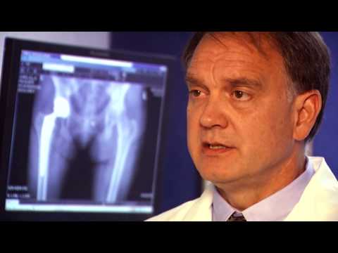 Sentara - Dr. Wilford Gibson, orthopedic surgeon at Sentara OrthoJoint Center at Sentara Hospital talks about hip pain and joint replacement. More information is avail...