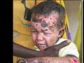 Darfur Genocide