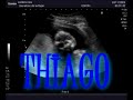 Thiago - 19 semanas de gestacion