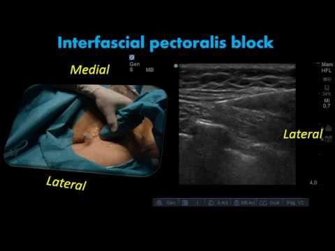 how to administer ultrasound