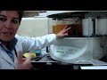 Placas Histológicas - PATOLOGÍA- Dr. Fernando Torres Jaramillo