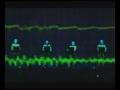 JAN POPESCU ELECTROCARDIOGRAM KRAFTWERK