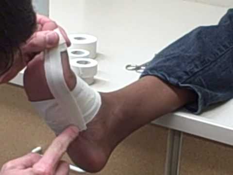 how to cure turf toe fast