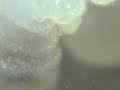 Camponotus ligniperda Larvae / Acari Camponotus ligniperda Larvae / Acari