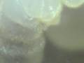 Camponotus ligniperda Larvae / Acari