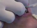 Cheap, Fast Teeth Whitening