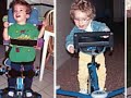 Canavan disease 0002