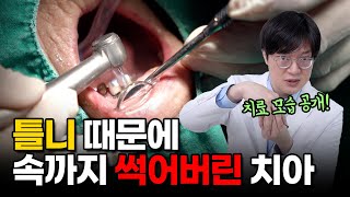 미래플란트치과