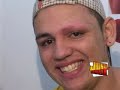 JONAS FORRÓ DEPILAÇÃO