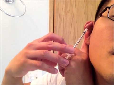 how to self syringe your ears