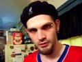 Benzodiazepine Anxiety Panic DrugWithdrawal