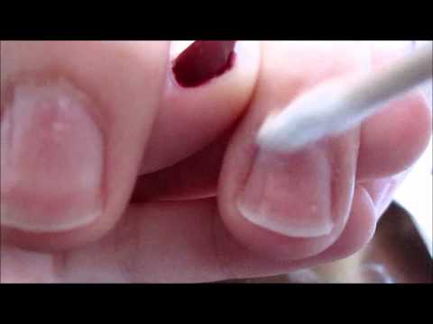 how to remove cuticles