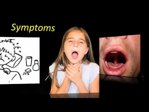 how to cure uvulitis