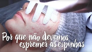 Fica a Dica – Por que não devemos espremer as espinhas?