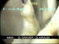 bankart arthroscopique