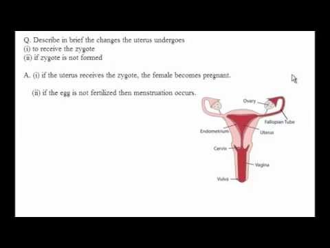 how to get rid of a zygote