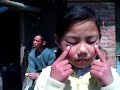 Chinese little girl - Doing Chinese Eye Exercise Chinese little girl - Doing Chinese Eye Exercise