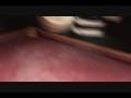 videos de Liquid Nitrogen on Pool Table