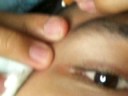 Facial Session Ongoing! Part 4/7 Facial Session Ongoing! Part 4/7