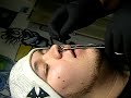 Cash's nose.MP4