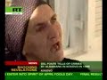 kosovo-serbs-were-butchered-for-organs.html