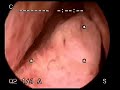 Medical - Cystoscopy