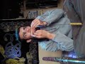 Hardguinbarde psyloget.3gp