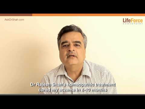 how to cure eczema on legs