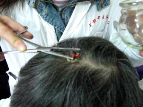 See video