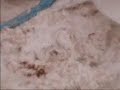 recover starch potato from waste water recover starch potato from waste water