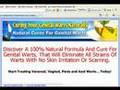 Cure For Genital Warts
