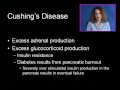 Cushing's Disease