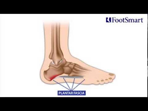 how to treat heel pain