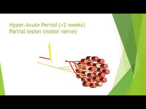 video-linktoworks-Nerve damage and repair