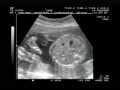 Echo 20060519-0.avi